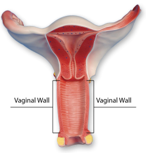 genital-33