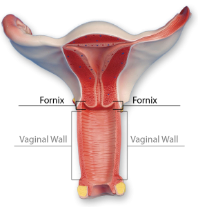 genital-36