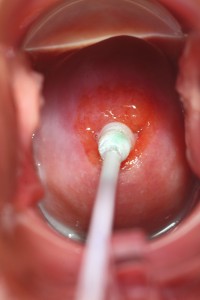 genital-cervix-1