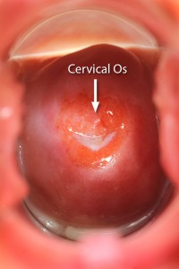 genital-cervix-2