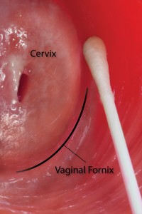 genital-fornix-1