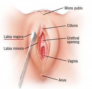 graphic-1